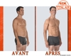 Total abs